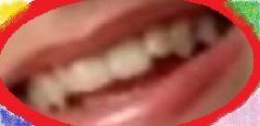 Xar