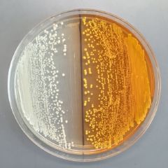19opiates2 articleLarge