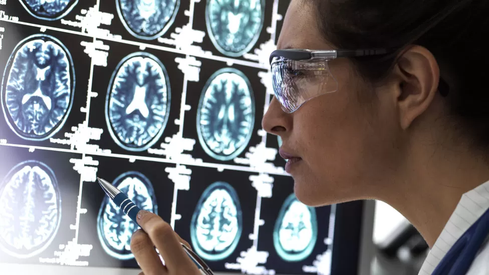 Lecanemab: Το πρώτο φάρμακο που επιβραδύνει τη νόσο Αλτσχάιμερ